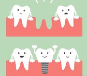 Dental Implants Cost Australia- My Gentle Dentist